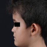 LATERAL-