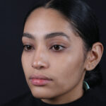 RINOPLASTIA OBLICUO-