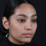 RINOPLASTIA OBLICUO