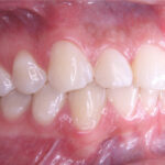 INTRAORAL1