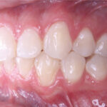 INTRAORAL2