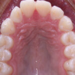 INTRAORAL3