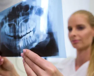 Usos Principales de la Radiología Oral